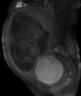 cyaaet1wi-sagittal-1-web.jpg
