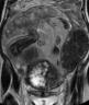 cyaaet2wi-coronal-1-web.jpg