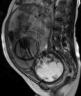 cyaaet2wi-sagittal-1web.jpg